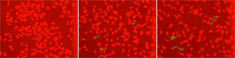 Tracking of three distinct cells